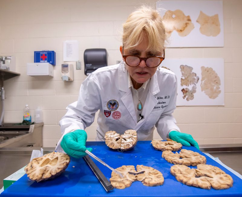 What is CTE and what NFL players have been diagnosed with it?